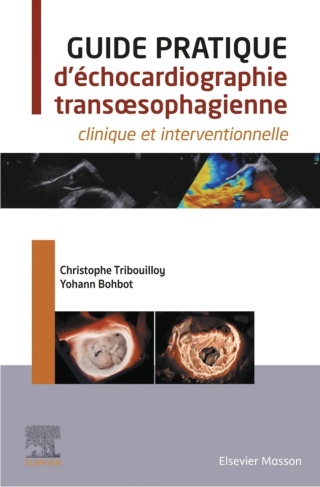 Cover image: Guide pratique d'échocardiographie transœsophagienne 1st edition 9782294784064