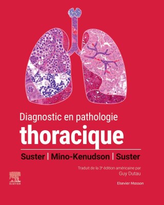 Cover image: Diagnostic en pathologie thoracique 1st edition 9782294784224
