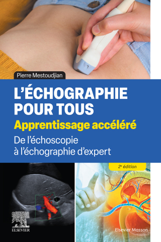 Imagen de portada: L'échographie pour tous : apprentissage accéléré 2nd edition 9782294785481