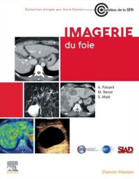 Cover image: Imagerie du foie 1st edition 9782294785627