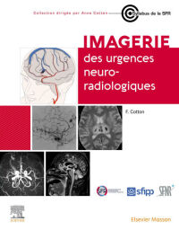 Cover image: Imagerie des urgences neuroradiologiques 1st edition 9782294786280