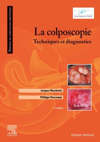 Cover image: La colposcopie 5th edition 9782294787904
