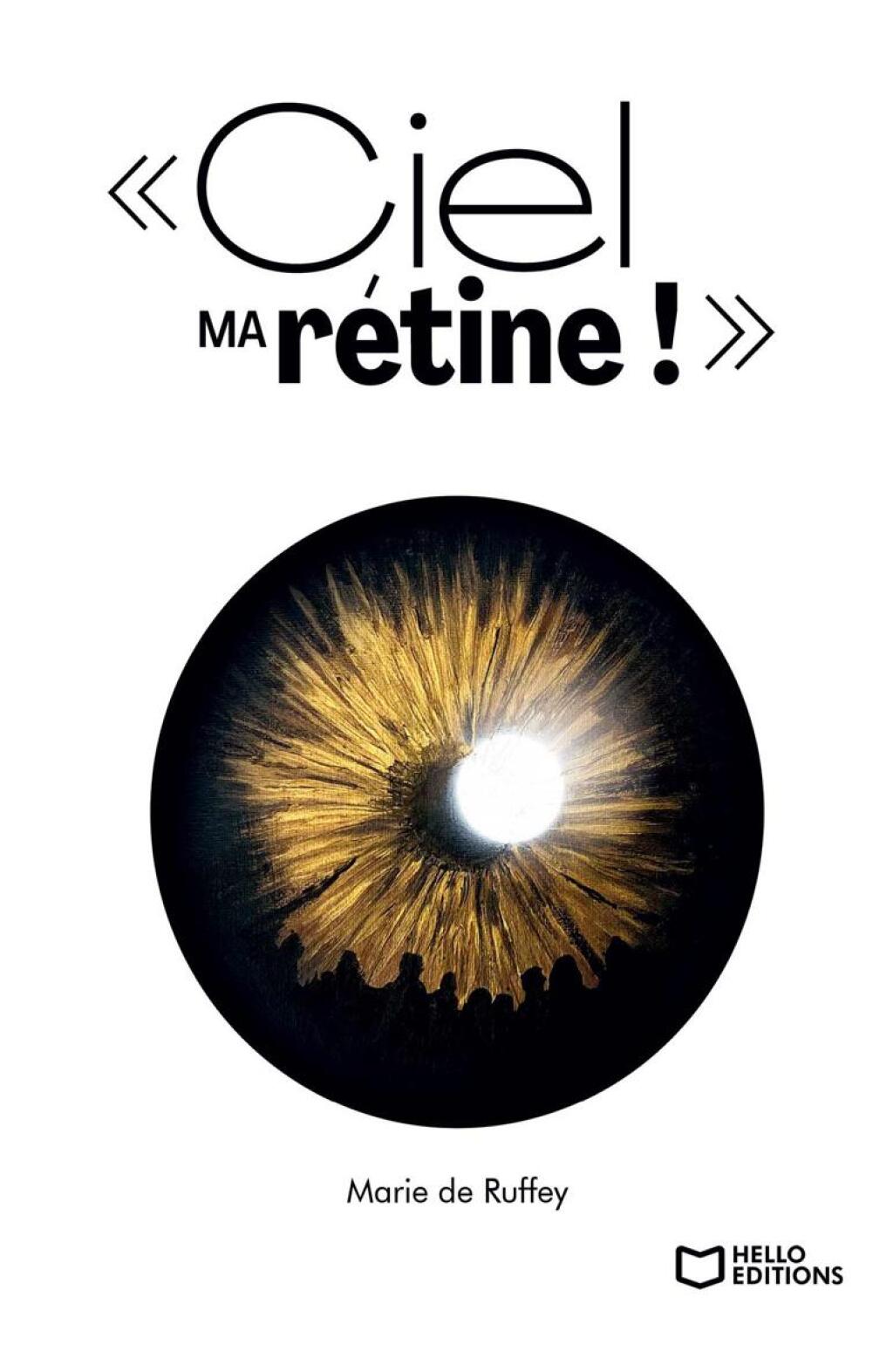 Ciel ma rétine ! Chroniques d’une cécité annoncée
