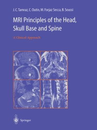 صورة الغلاف: MRI Principles of the Head, Skull Base and Spine 9782817807560