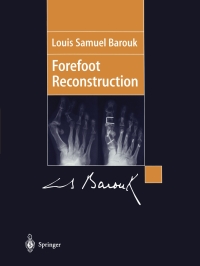 Imagen de portada: Forefoot Reconstruction 9782287596568