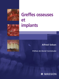 Titelbild: Greffes osseuses et implants 9782294704970