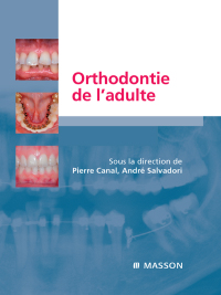 Omslagafbeelding: Orthodontie de l’adulte 9782294703256