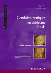 Cover image: Conduites pratiques en médecine foetale 9782294706264