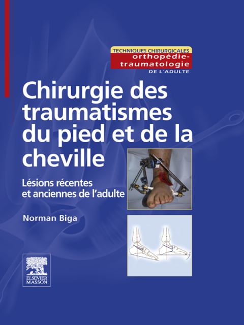 Chirurgie des traumatismes du pied et de la cheville: Lésions récentes et anciennes de l'adulte - FULL INSTANT DOWNLOAD | PDF DOCX EPUB