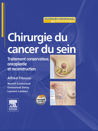 Cover image: Chirurgie du cancer du sein 9782294062452