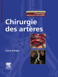 Imagen de portada: Chirurgie des artères 9782294704383