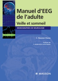 Cover image: Manuel d'EEG de l'adulte 9782294071454