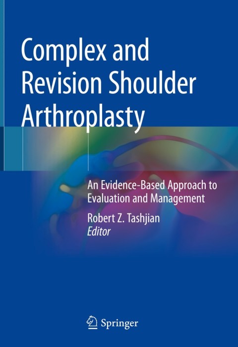 Complex and Revision Shoulder Arthroplasty: An Evidence-Based Approach to Evaluation and Management - FULL INSTANT DOWNLOAD | PDF DOCX EPUB