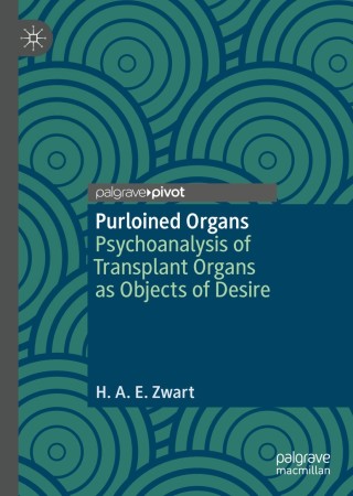 Omslagafbeelding: Purloined Organs 9783030053536
