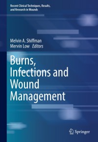 表紙画像: Burns, Infections and Wound Management 9783030106850