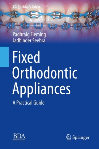 Cover image: Fixed Orthodontic Appliances 9783030121648