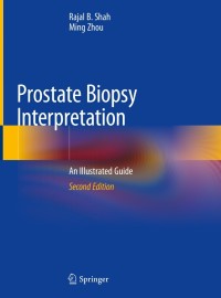 Imagen de portada: Prostate Biopsy Interpretation 2nd edition 9783030136000
