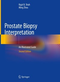 صورة الغلاف: Prostate Biopsy Interpretation 2nd edition 9783030136000