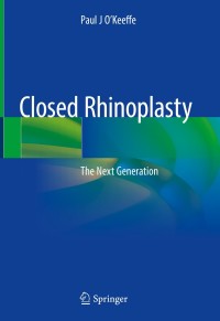 Titelbild: Closed Rhinoplasty 9783030168513