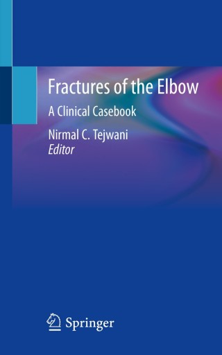 Cover image: Fractures of the Elbow 9783030228569