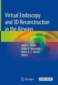 Immagine di copertina: Virtual Endoscopy and 3D Reconstruction in the Airways 9783030232528