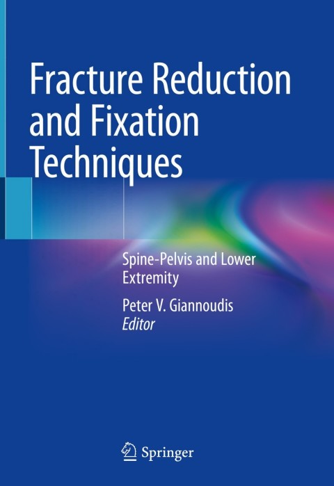 Fracture Reduction and Fixation Techniques: Spine-Pelvis and Lower Extremity - FULL INSTANT DOWNLOAD | PDF DOCX EPUB