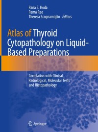 Omslagafbeelding: Atlas of Thyroid Cytopathology on Liquid-Based Preparations 9783030250652