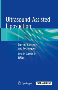 Titelbild: Ultrasound-Assisted Liposuction 9783030268749