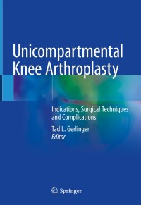 Imagen de portada: Unicompartmental Knee Arthroplasty 9783030274108