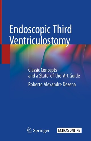 Omslagafbeelding: Endoscopic Third Ventriculostomy 9783030286569