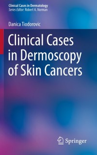 Cover image: Clinical Cases in Dermoscopy of Skin Cancers 9783030294465