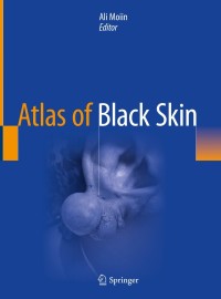 صورة الغلاف: Atlas of Black Skin 9783030314842