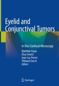 Cover image: Eyelid and Conjunctival Tumors 1st edition 9783030366056