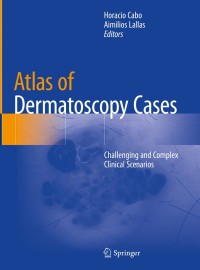 Cover image: Atlas of Dermatoscopy Cases 1st edition 9783030436711