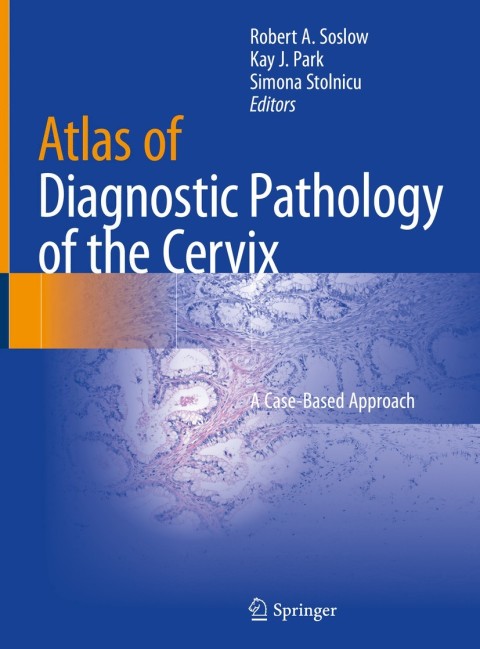 Atlas of Diagnostic Pathology of the Cervix: A Case-Based Approach, 1st Edition - FULL INSTANT DOWNLOAD | PDF DOCX EPUB