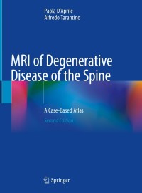 Cover image: MRI of Degenerative Disease of the Spine 2nd edition 9783030737061