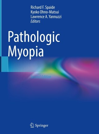 Imagen de portada: Pathologic Myopia 2nd edition 9783030743338