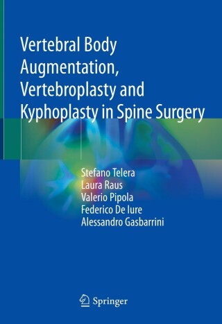 Omslagafbeelding: Vertebral Body Augmentation, Vertebroplasty and Kyphoplasty in Spine Surgery 9783030765545