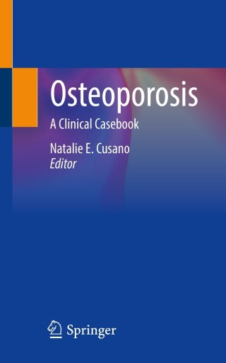 Imagen de portada: Osteoporosis 9783030839505