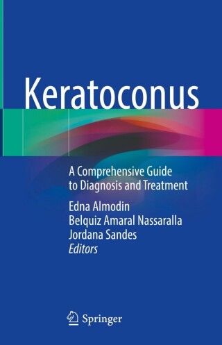 Cover image: Keratoconus 9783030853600