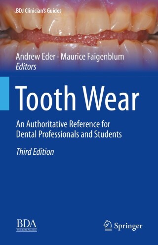 Imagen de portada: Tooth Wear 3rd edition 9783030861094