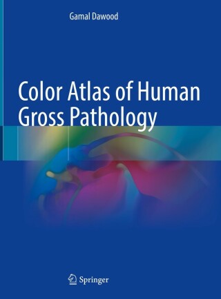Cover image: Color Atlas of Human Gross Pathology 9783030913144