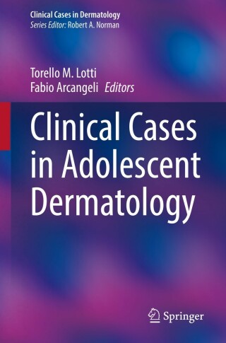 表紙画像: Clinical Cases in Adolescent Dermatology 9783030915254