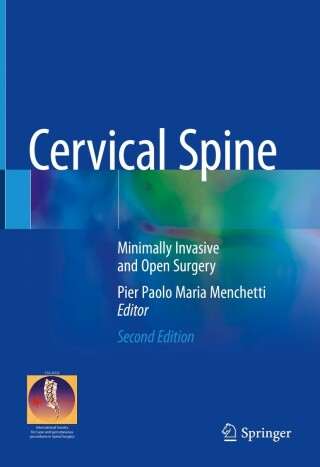 Imagen de portada: Cervical Spine 2nd edition 9783030948283
