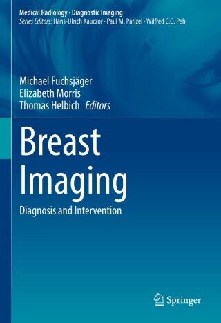 Cover image: Breast Imaging 9783030949174