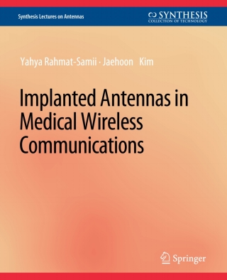 Immagine di copertina: Implanted Antennas in Medical Wireless Communications 9783031004032