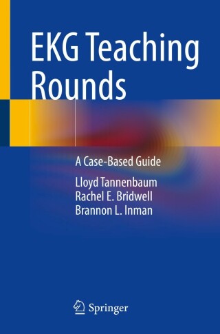 Immagine di copertina: EKG Teaching Rounds 9783031060274