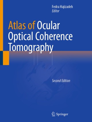 Imagen de portada: Atlas of Ocular Optical Coherence Tomography 2nd edition 9783031074097