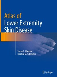 表紙画像: Atlas of Lower Extremity Skin Disease 9783031079498