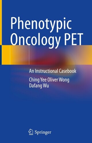 表紙画像: Phenotypic Oncology PET 9783031097362